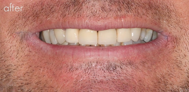 Before dental treatment at Park Dental Care Before dental treatment at Park Dental Care