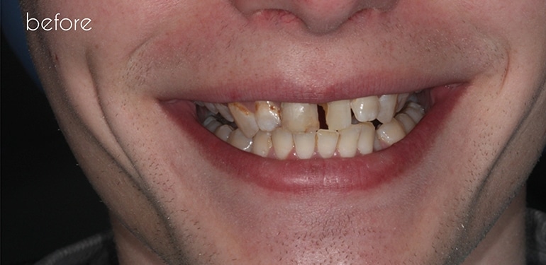 Before dental treatment at Park Dental Care