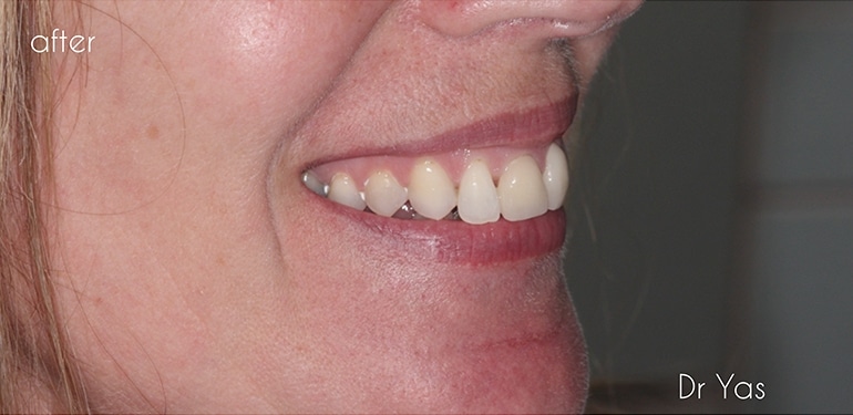 Before dental treatment at Park Dental Care