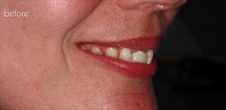 Before dental treatment at Park Dental Care