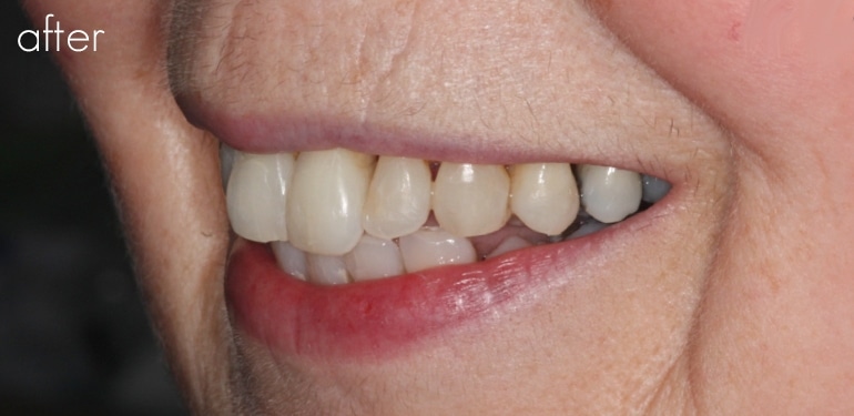 Before dental treatment at Park Dental Care