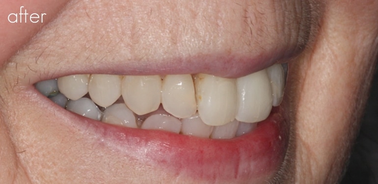 Before dental treatment at Park Dental Care