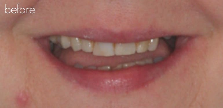 Before dental treatment at Park Dental Care