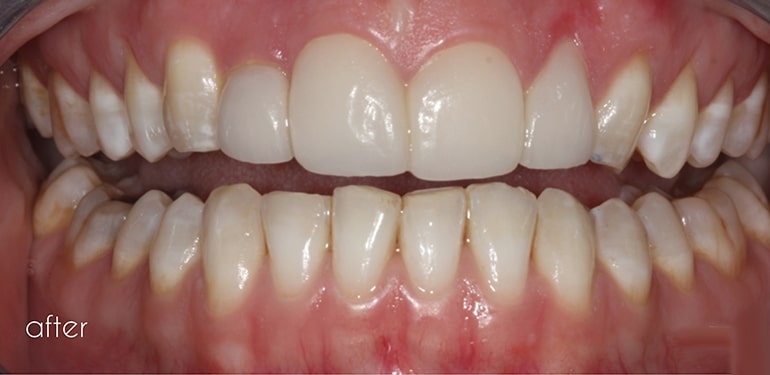 Before dental treatment at Park Dental Care